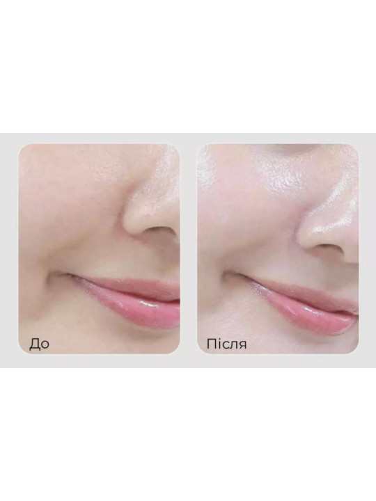 Відновлюючий тонер Medi-Peel Phyto Exosome PDRN Lifting Shot Toner, 130 мл