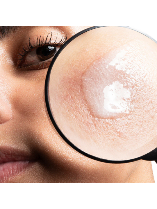 Сироватка освітлююча з азелаїновою кислотою Azelaic & Kojic Advanced Clarifying Serum Allies of skin, 30 мл